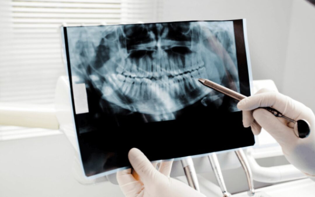 The Future of Dental Radiography: Online Courses in Canada