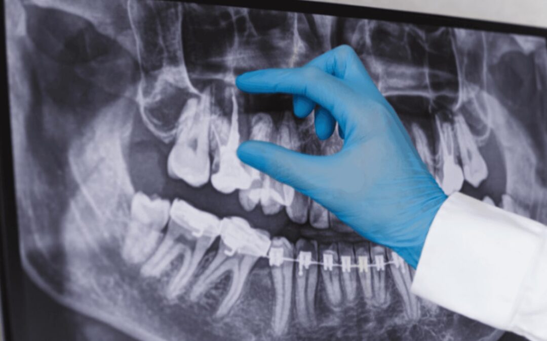 Navigating Radiography Certifications for Dental Assistants in Canada