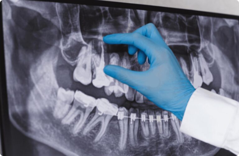 Navigating Radiography Certifications for Dental Assistants in Canada